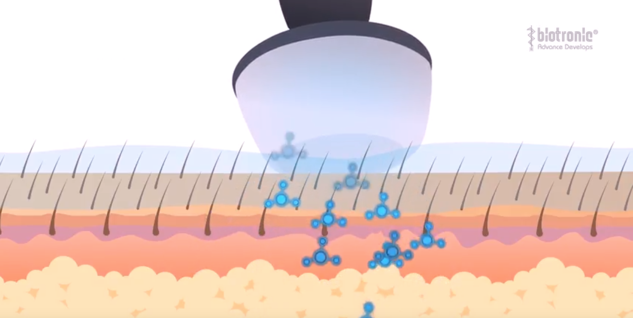 Beneficios del ultrasonido en fisioterapia